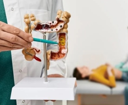 Những ai có nguy cơ cao mắc ung thư đại tràng và cần tầm soát sớm?